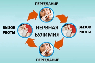 Лечение булимии в Надежде